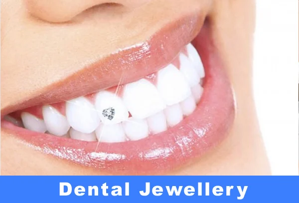 Dental Jewellery